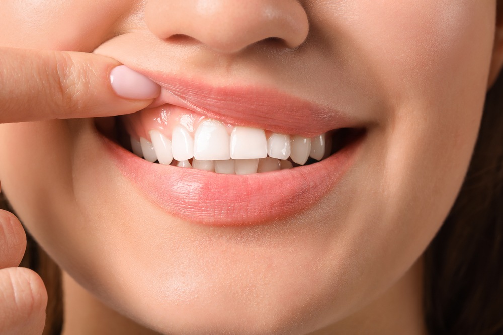 Young woman with healthy gums, closeup